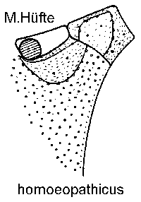 ACRITUS3.GIF